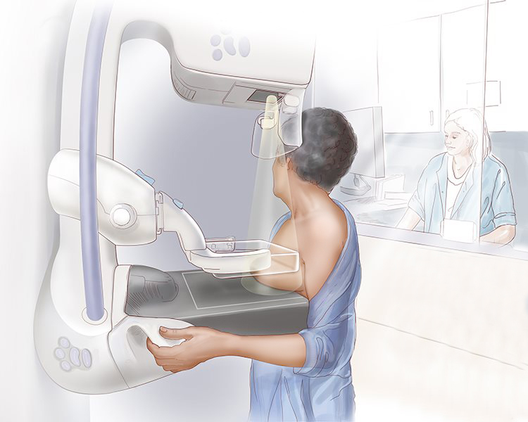 breast-mammography.jpg
